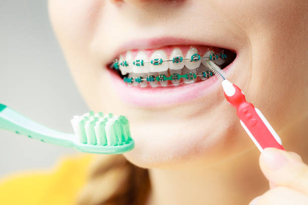 Gum Interdental Brushes for Protecting Oral Health